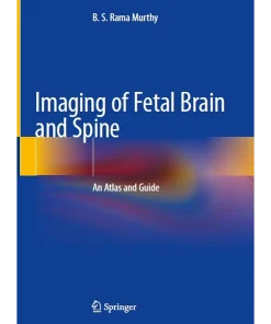Imaging of Fetal Brain and Spine An Atlas and Guide