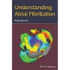 Understanding Atrial Fibrillation