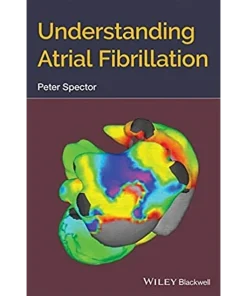 Understanding Atrial Fibrillation
