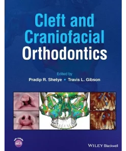 Cleft and Craniofacial Orthodontics