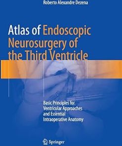 Atlas of Endoscopic Neurosurgery of the Third Ventricle Basic Principles for Ventricular Approaches and Essential Intraoperative Anatomy
