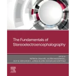 The Fundamentals of Stereoelectroencephalography