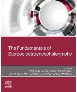 The Fundamentals of Stereoelectroencephalography