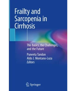 Frailty and Sarcopenia in Cirrhosis