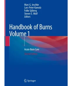 Handbook of Burns Volume 1