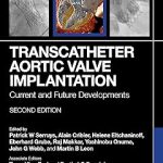 Transcatheter Aortic Valve Implantation Current and Future Developments