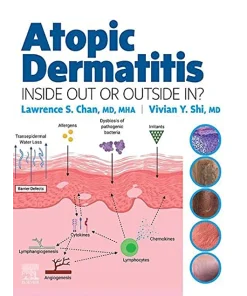 Elsevier Atopic Dermatitis: Inside Out or Outside In