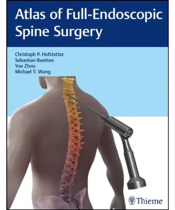 Atlas of Full-Endoscopic Spine Surgery