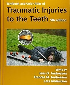 Wiley-Blackwell Textbook and Color Atlas of Traumatic Injuries to the Teeth