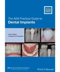 Wiley-Blackwell The ADA Practical Guide to Dental Implants