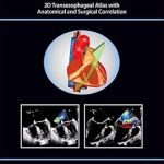 The Art of 2D Transesophageal Echocardiography 2D Transesophageal Atlas with Anatomical and Surgical Correlation