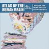 Atlas of the Human Brain