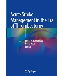 Acute Stroke Management in the Era of Thrombectomy