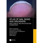 Atlas of Nail Signs and Disorders with Clinical and Onychoscopic Correlation