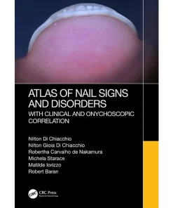 Atlas of Nail Signs and Disorders with Clinical and Onychoscopic Correlation