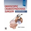 Endoscopic Craniosynostosis Surgery