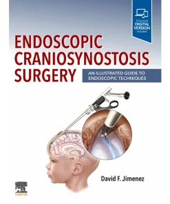 Endoscopic Craniosynostosis Surgery