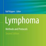 Lymphoma