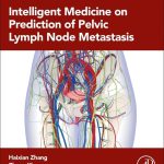 Intelligent Medicine on Prediction of Pelvic Lymph Node Metastasis