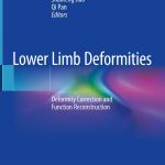 Lower Limb Deformities