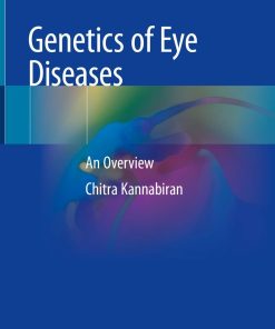 Genetics of Eye Diseases
