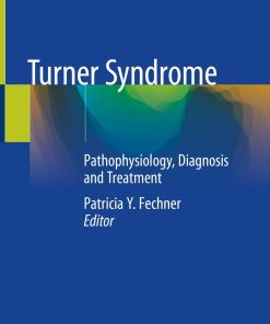 Turner Syndrome