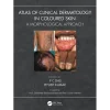 Atlas of Clinical Dermatology in Coloured Skin A Morphological Approach