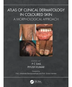 Atlas of Clinical Dermatology in Coloured Skin A Morphological Approach