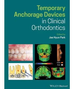 Wiley-Blackwell Temporary Anchorage Devices in Clinical Orthodontics
