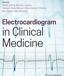 Electrocardiogram in Clinical Medicine