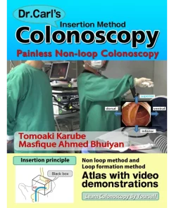 Dr. Carl's Colonoscopy insertion method