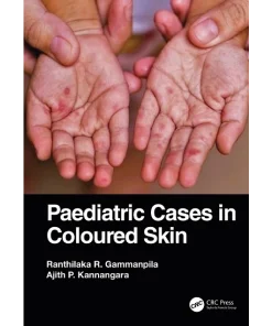 Paediatric Cases in Coloured Skin