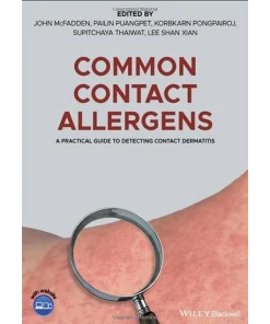 Common Contact Allergens
