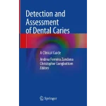 Detection and Assessment of Dental Caries