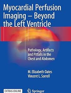 Myocardial Perfusion Imaging - Beyond the Left Ventricle