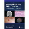 Non-melanoma Skin Cancer Essentials for Oncologists