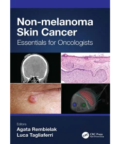 Non-melanoma Skin Cancer Essentials for Oncologists