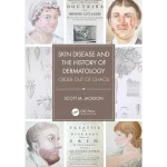 Skin Disease and the History of Dermatology