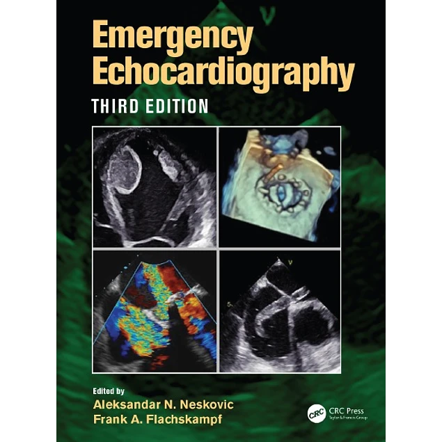 Emergency Echocardiography