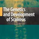 The Genetics and Development of Scoliosis