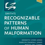 Smith's Recognizable Patterns of Human Malformatio