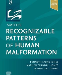 Smith's Recognizable Patterns of Human Malformatio