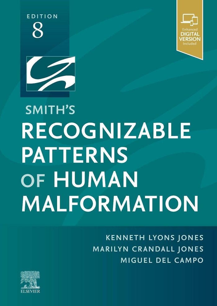 Smith's Recognizable Patterns of Human Malformatio