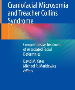 Craniofacial Microsomia and Treacher Collins Syndrome