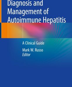 Diagnosis and Management of Autoimmune Hepatitis