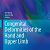 Congenital Deformities of the Hand and Upper Limb