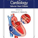 Case Reports in Cardiology Valvular Heart Disease
