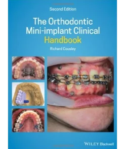 The Orthodontic Mini–implant Clinical Handbook
