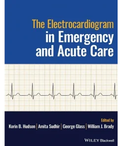 The Electrocardiogram in Emergency and Acute Care
