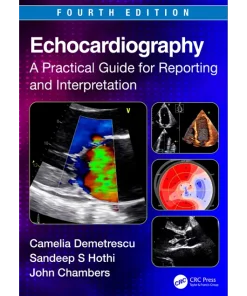 Echocardiography A Practical Guide for Reporting and Interpretation
